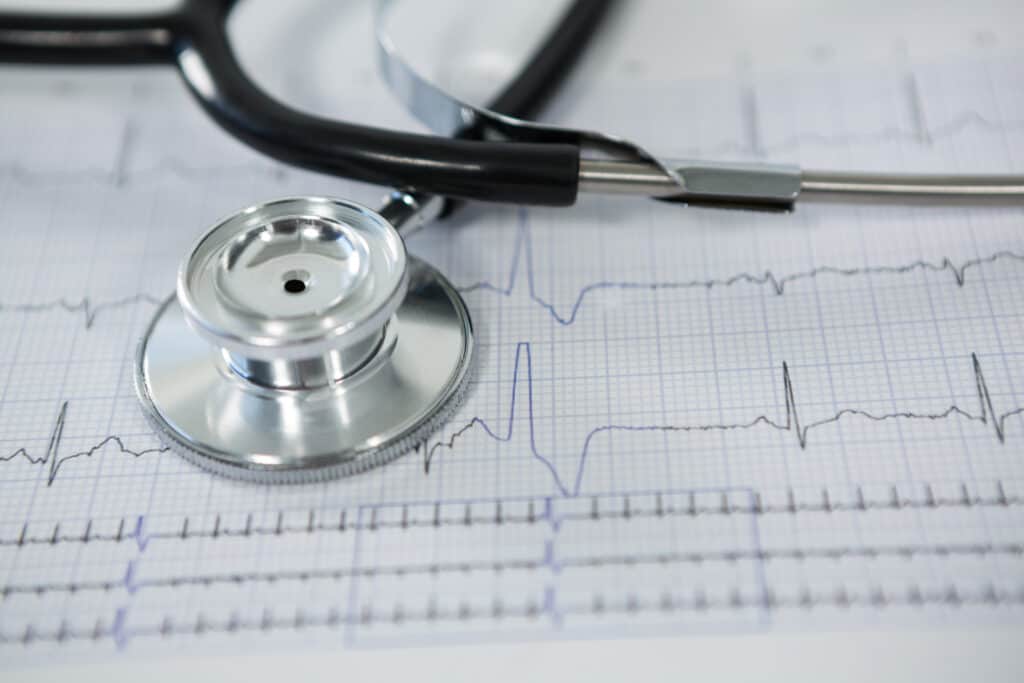 portable ecg